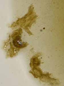 biofilm released in toilet