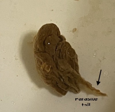 parasite evident in stool