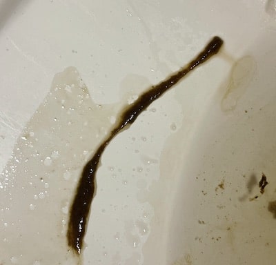 6 inch parasite in stool