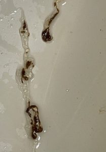 Roundworm image