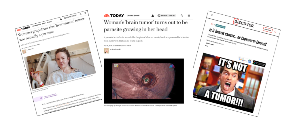 Cancer Or Parasites?