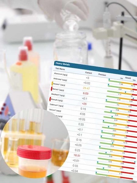 Toxin Testing